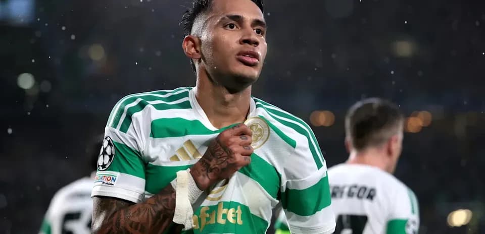 Jugador de Celtic mostrando su camiseta tras el partido