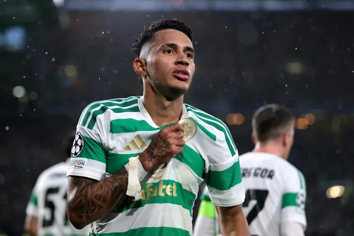 Jugador de Celtic mostrando su camiseta tras el partido